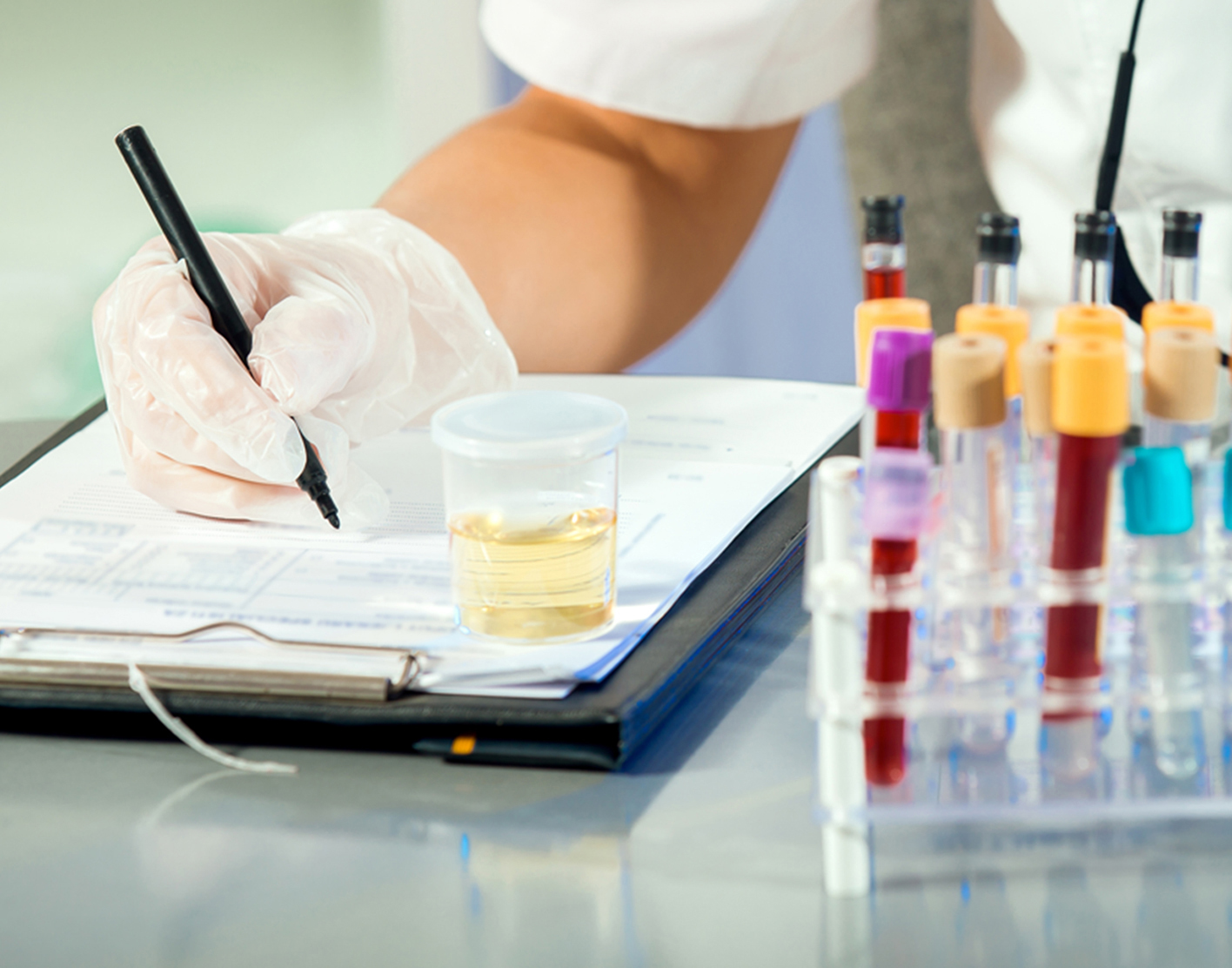 quantitative-bence-jones-protein-test-708x556-2x