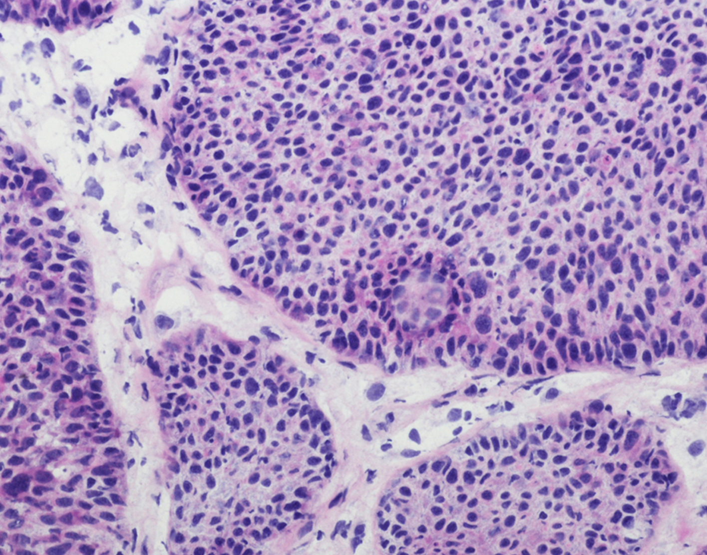 rectal-biopsy-708x556-2x