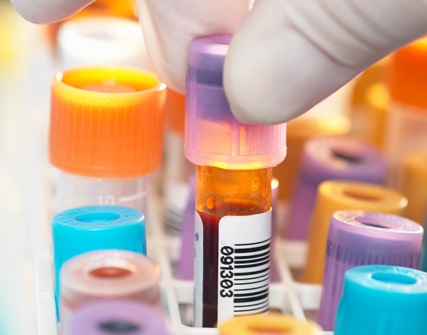 Screening and diagnosis for HIV