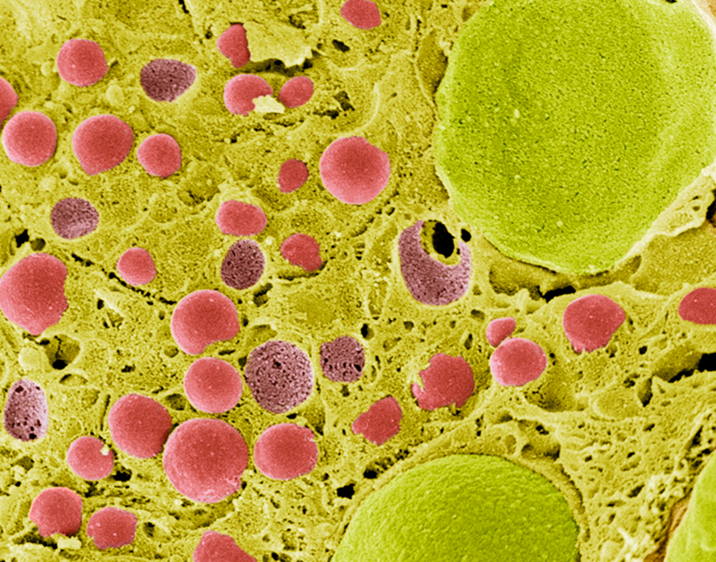 secretin-stimulation-test-708x556-2x