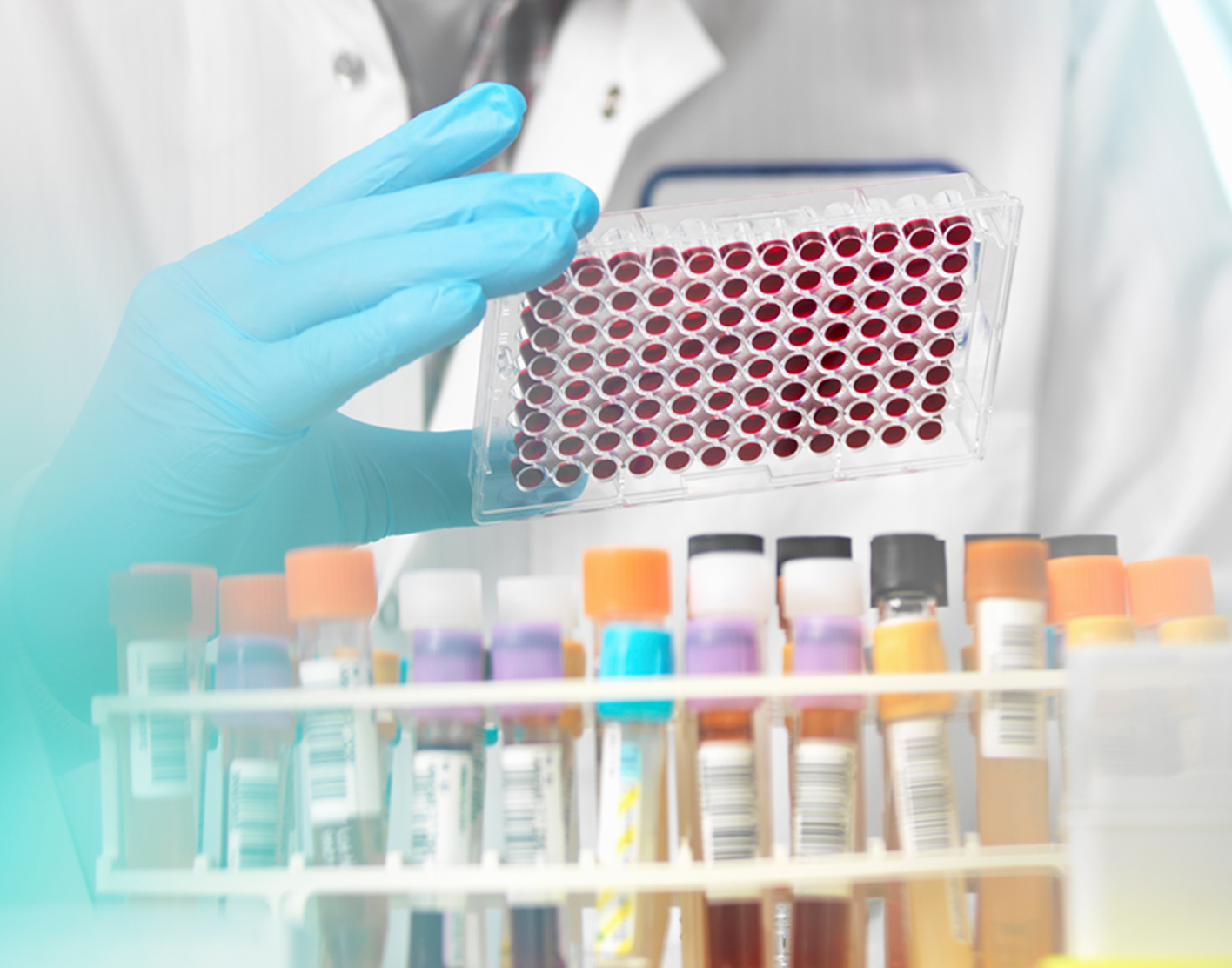 serum-globulin-electrophoresis-708x556-2x