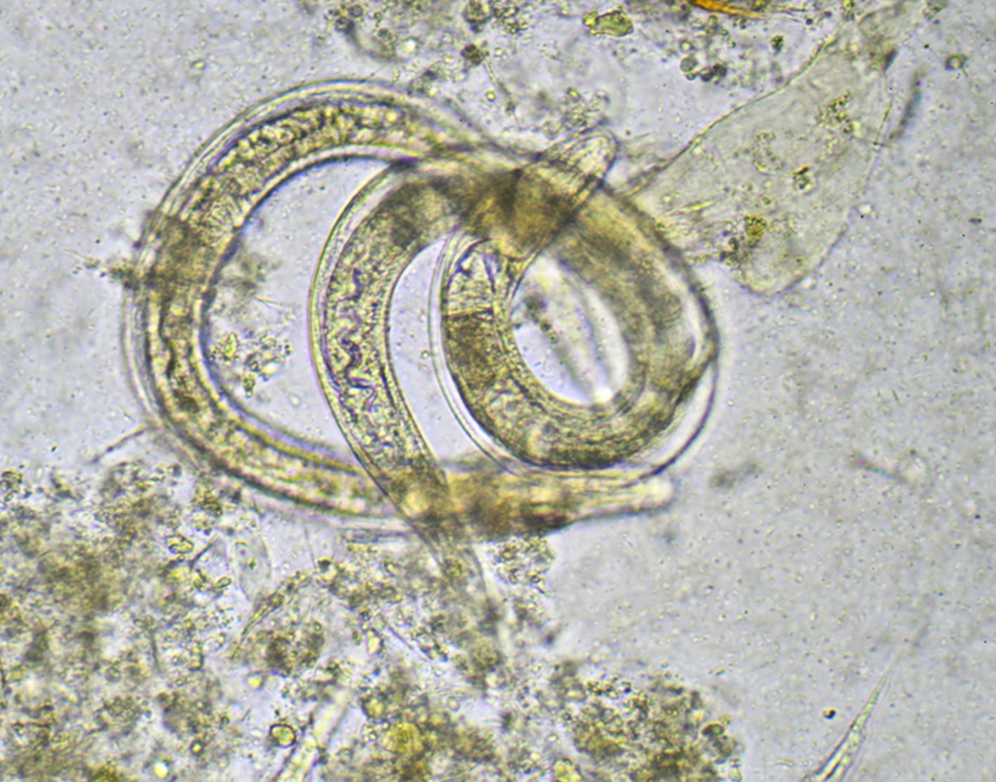 parasite eggs in stool