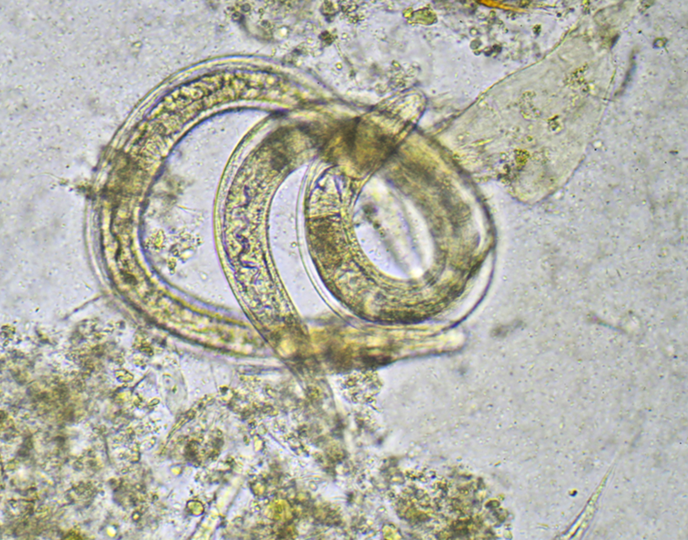 Stool ova and parasites exam