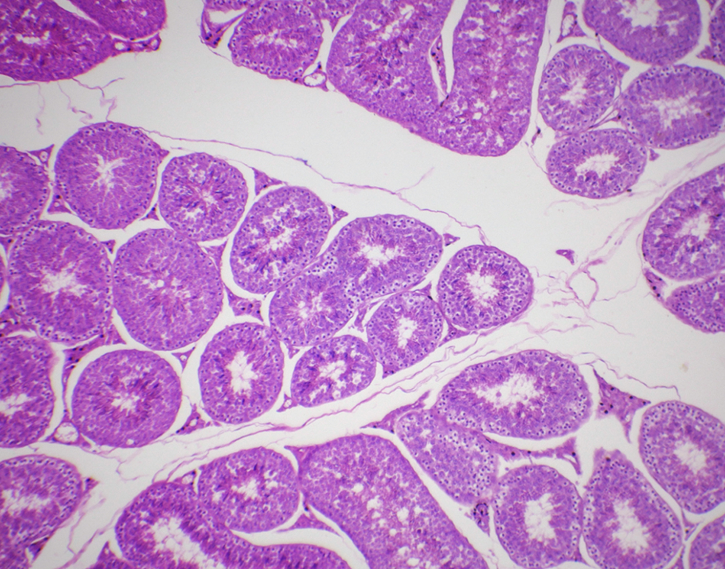 testicular-biopsy-708x556-2x