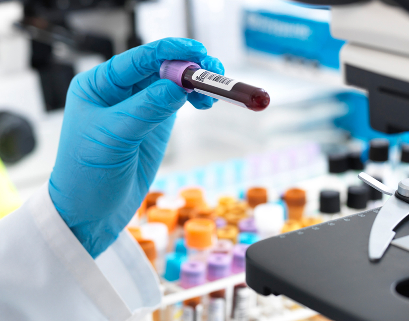 thyroid-function-tests-708x556-2x