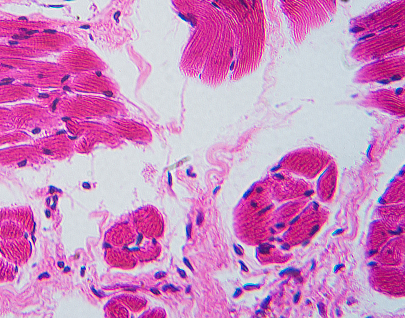 tongue-biopsy-708x556-2x