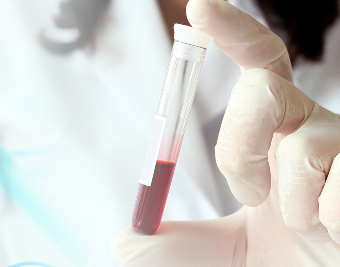 toxicology-screen-708x556-2x
