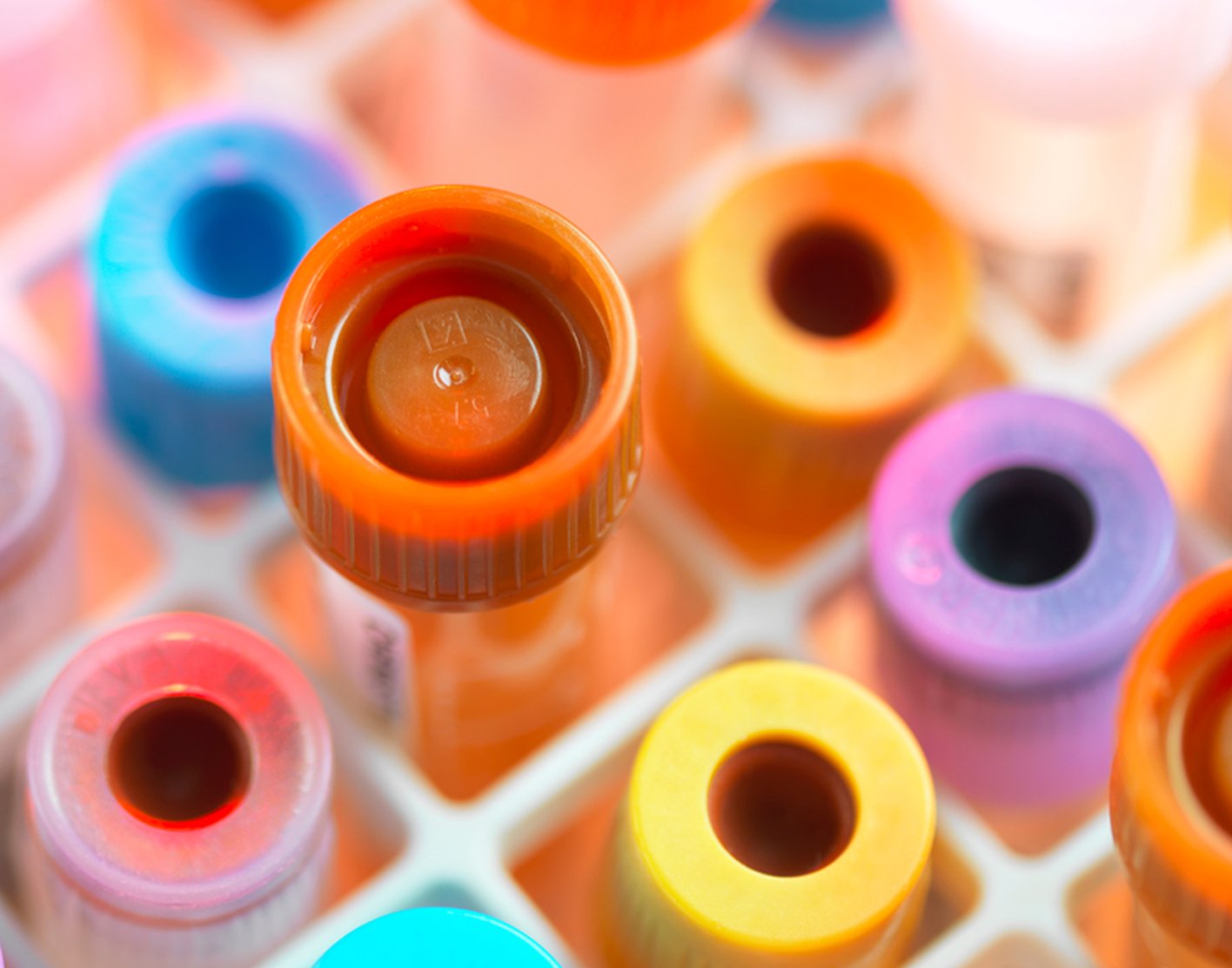 toxoplasma-blood-test-708x556-2x