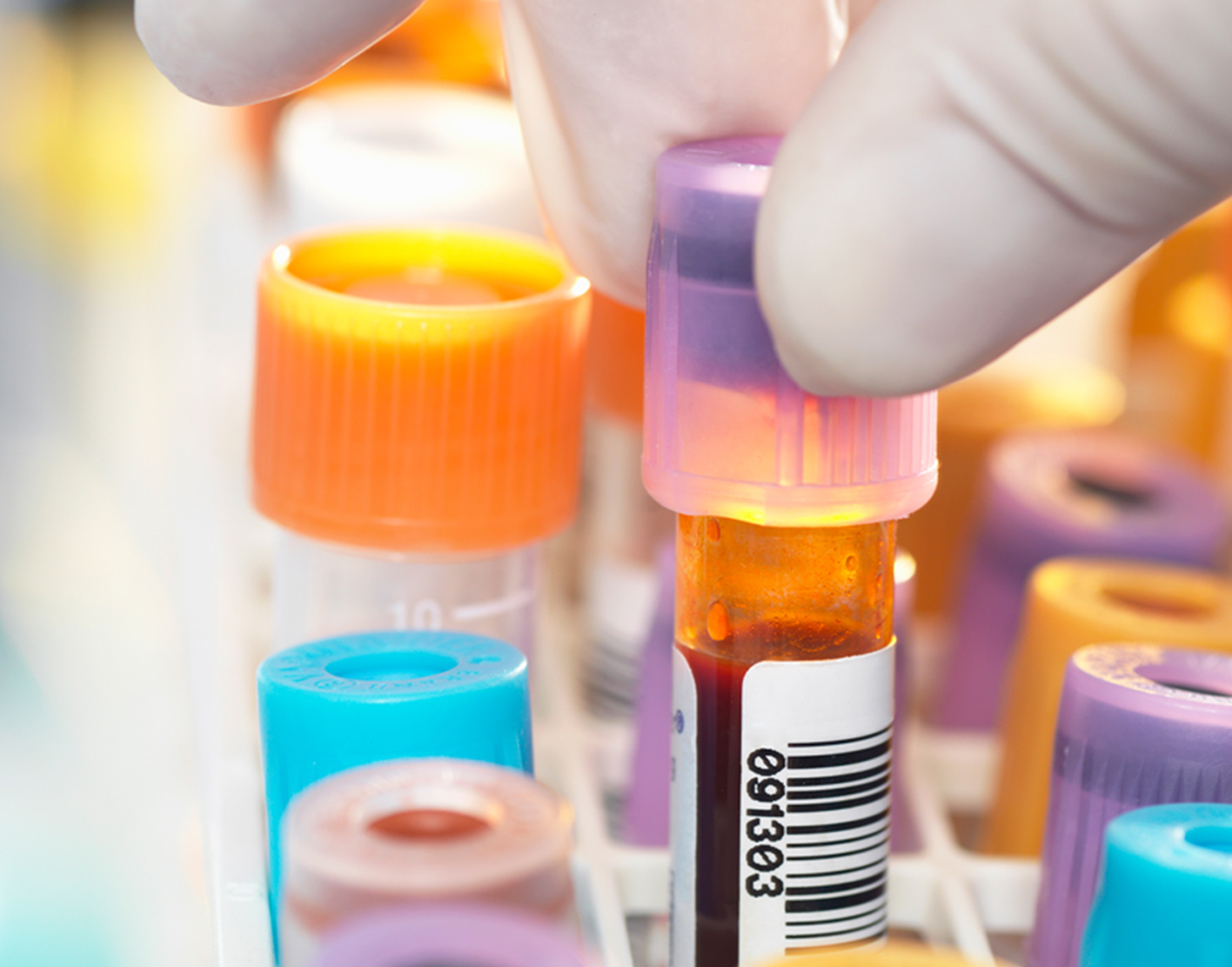 uric-acid-blood-708x556-2x