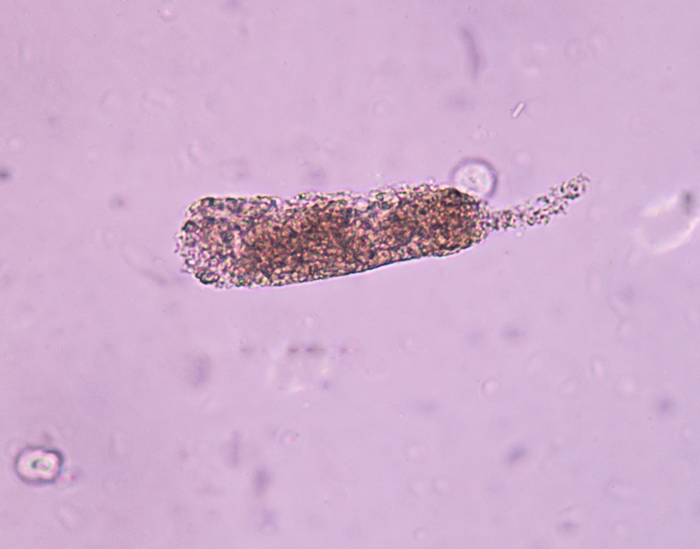 urinary-casts-708x556-2x