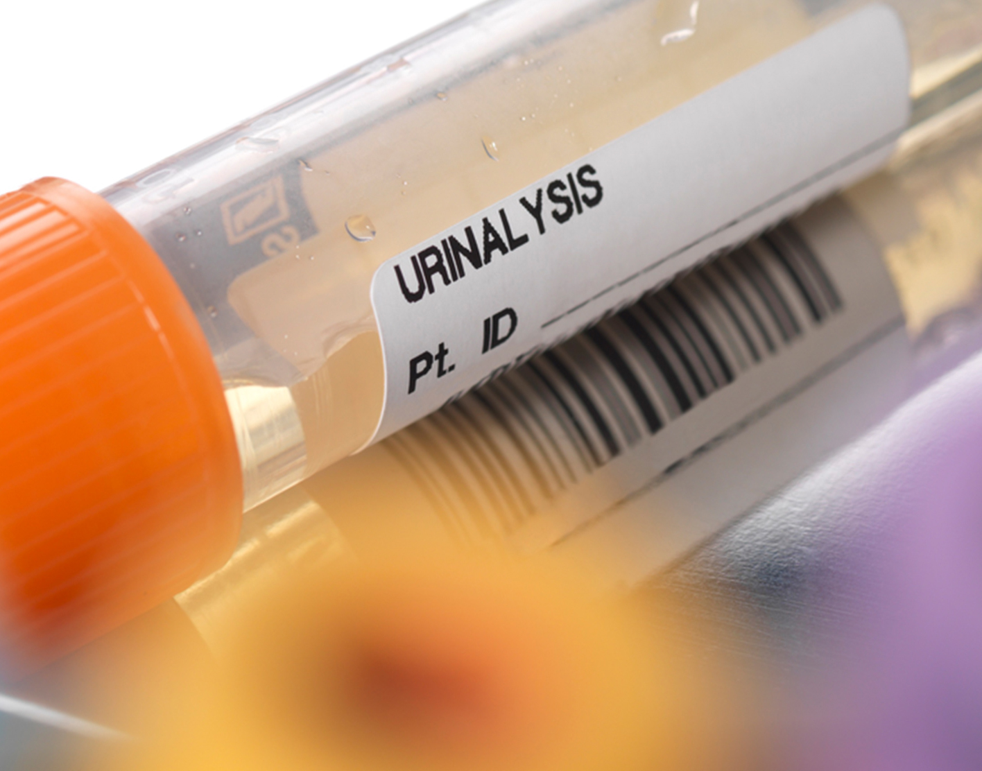 urine-culture-708x556-2x