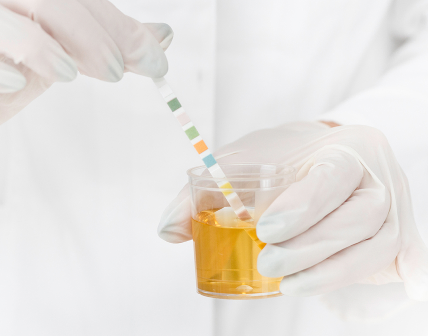 urine-ph-test-708x556-2x