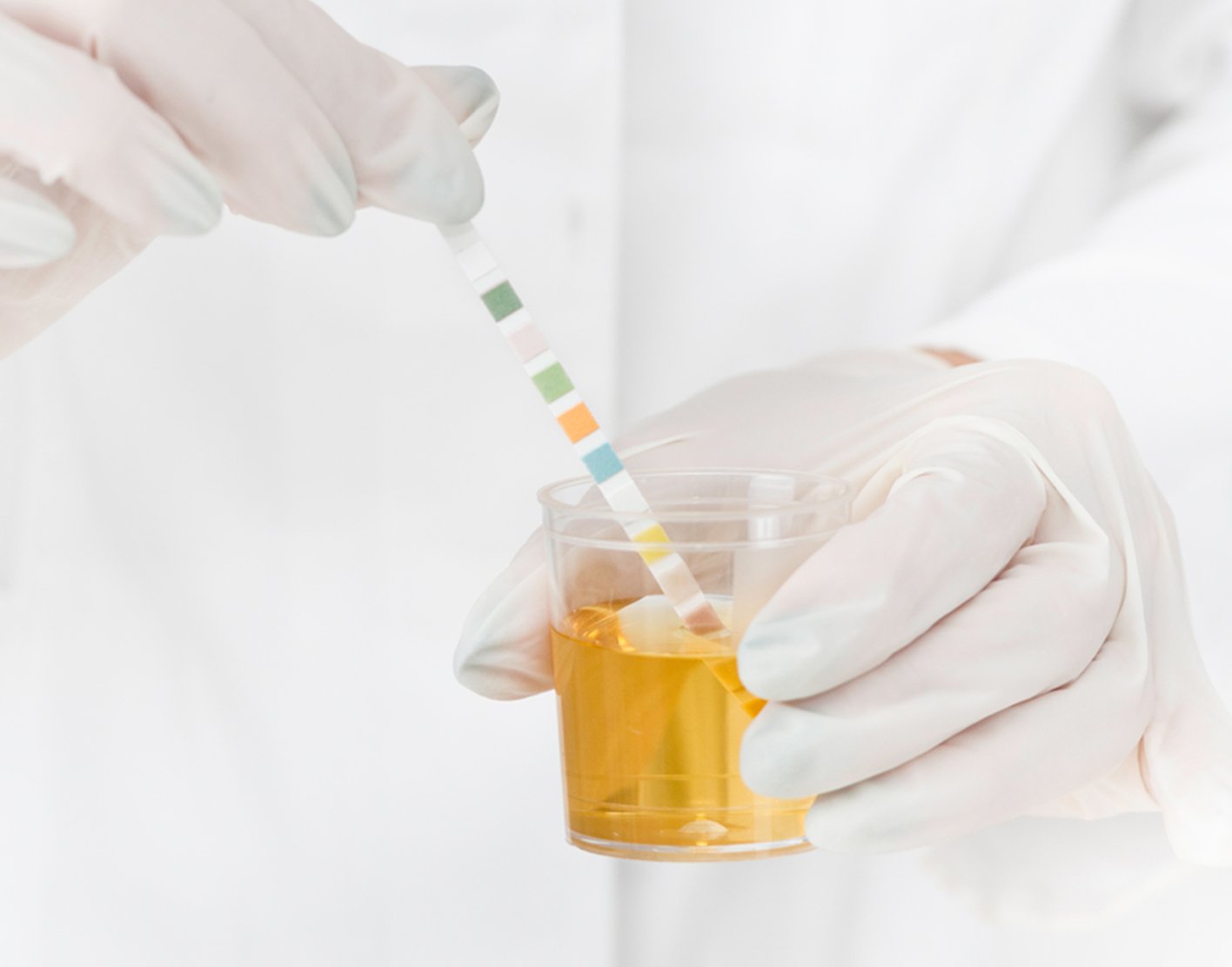 urine-ph-test-708x556-2x