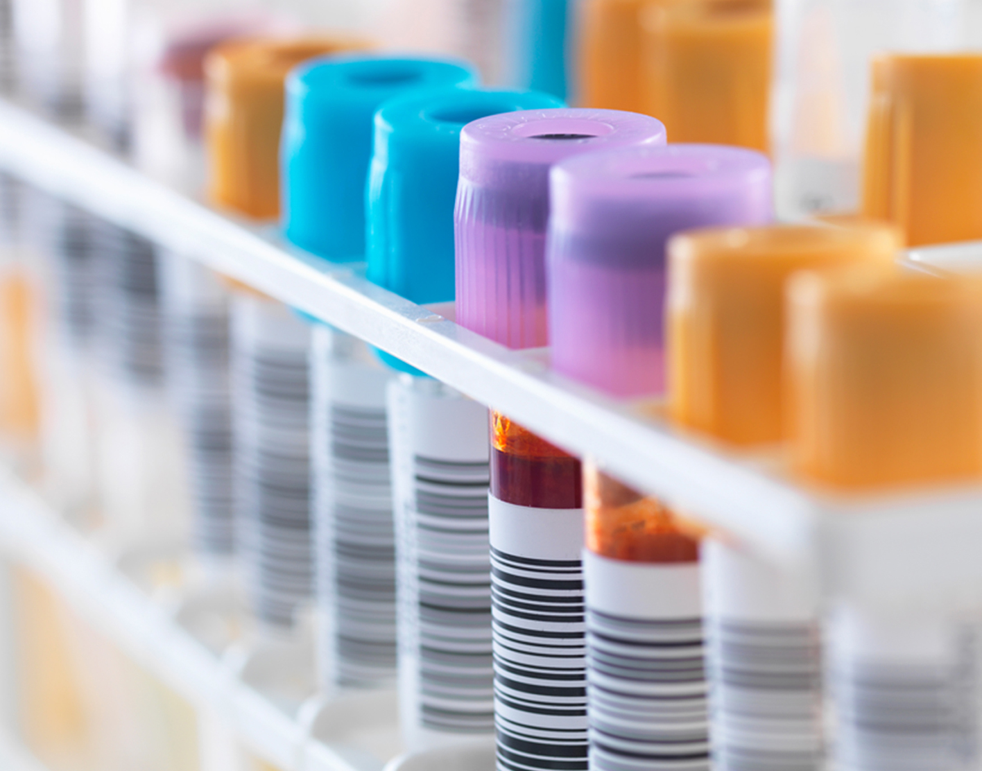 venipuncture-708x556-2x