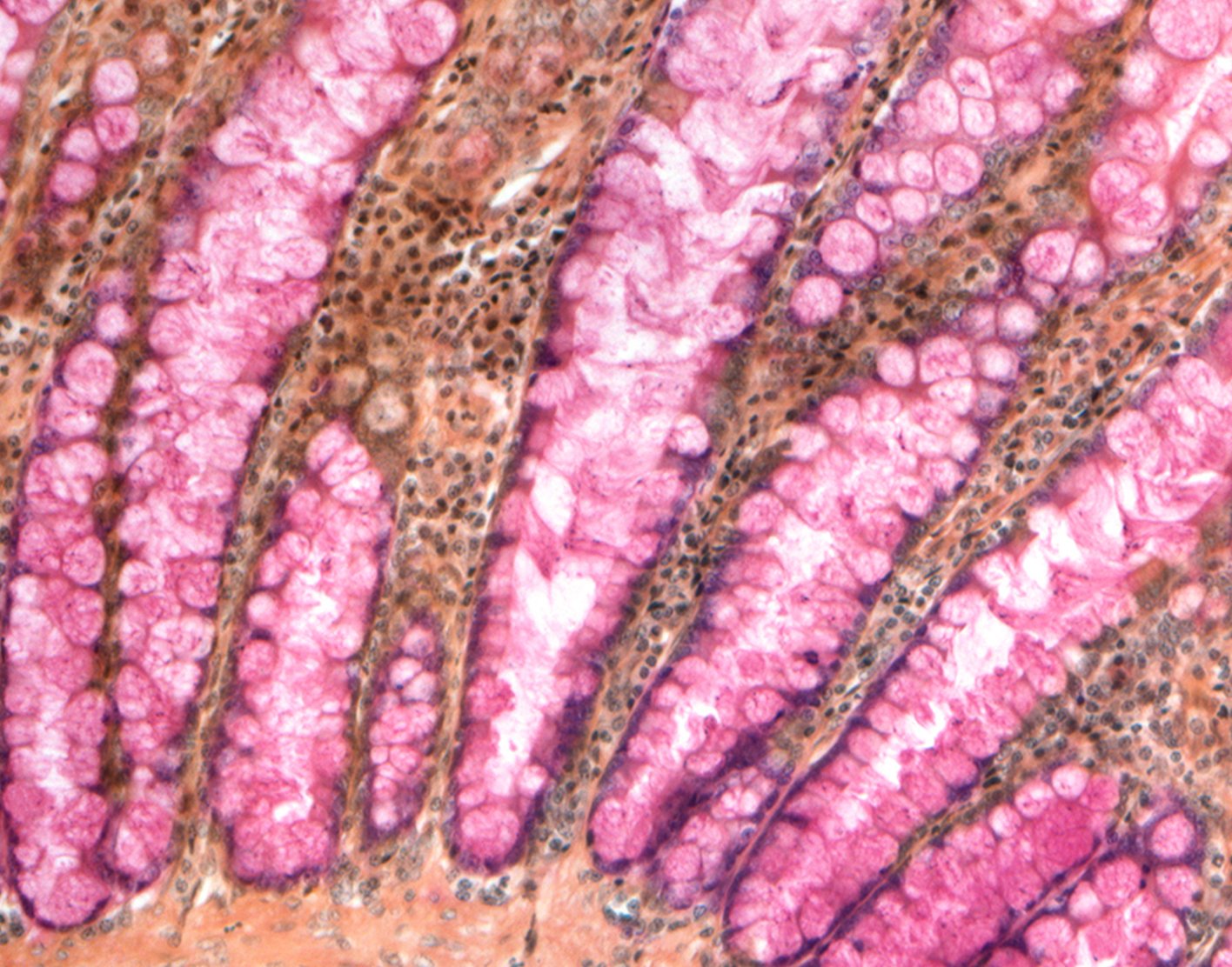 virtual-colonoscopy-708x556-2x