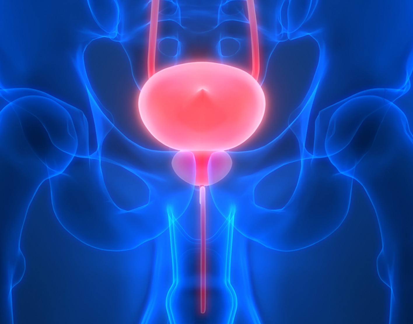 Voiding cystourethrogram
