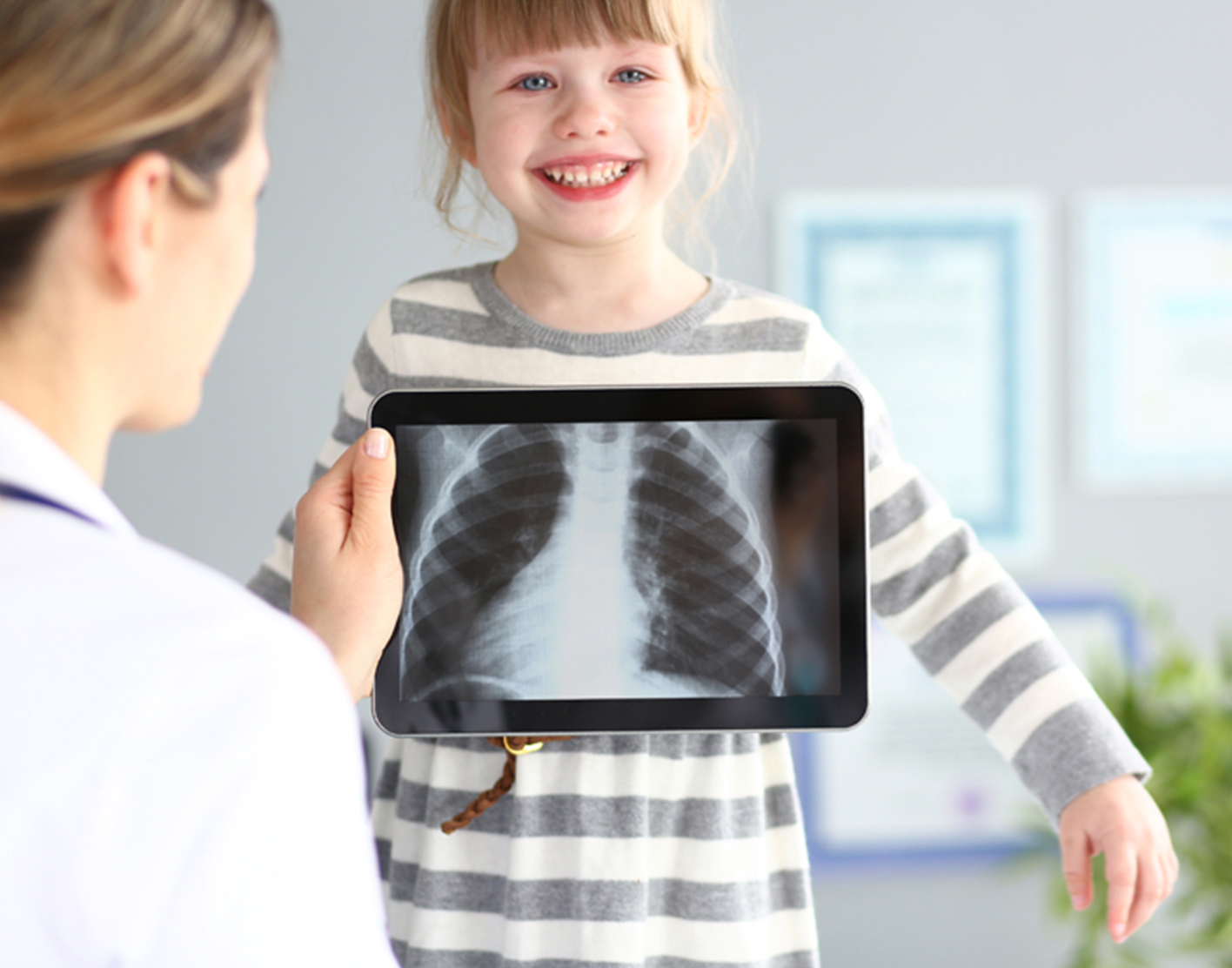 x-ray-708x556-2x