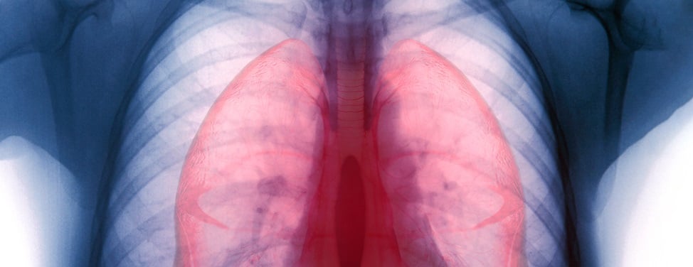 patient-ally-jenkins-2x