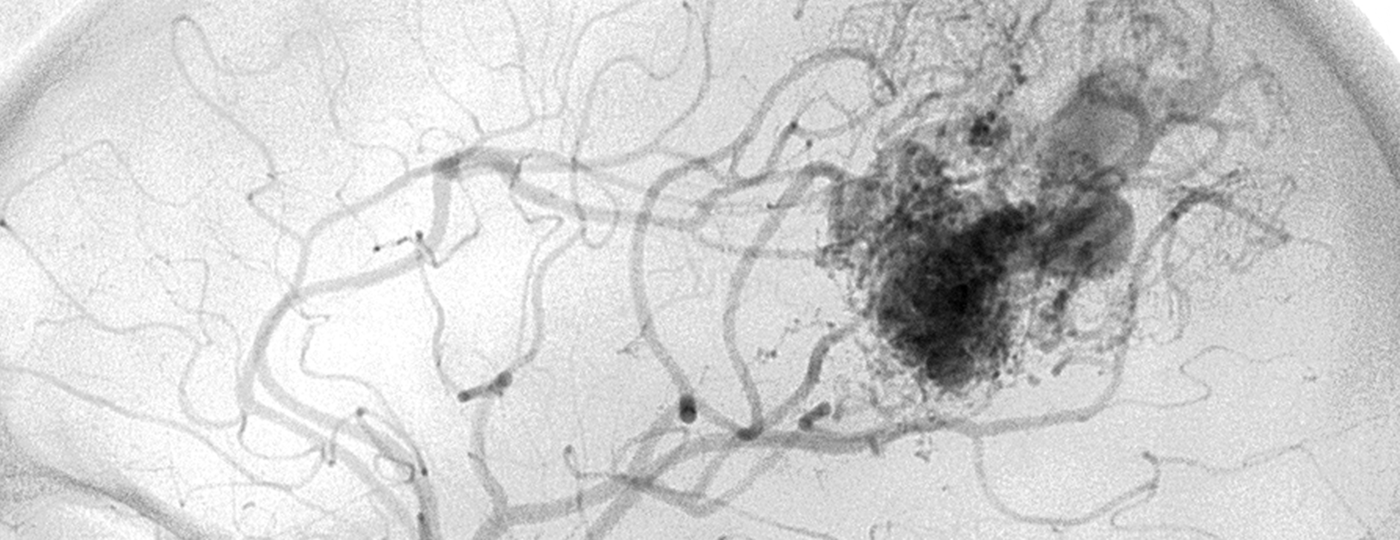 patient-lauren-mclaughlan-2x