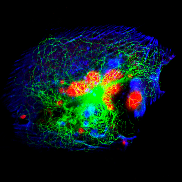 new-approaches-to-neuroblastoma-therapy-consortium-2x