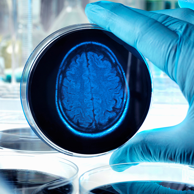 ucsf-department-of-psychiatry-research-2x