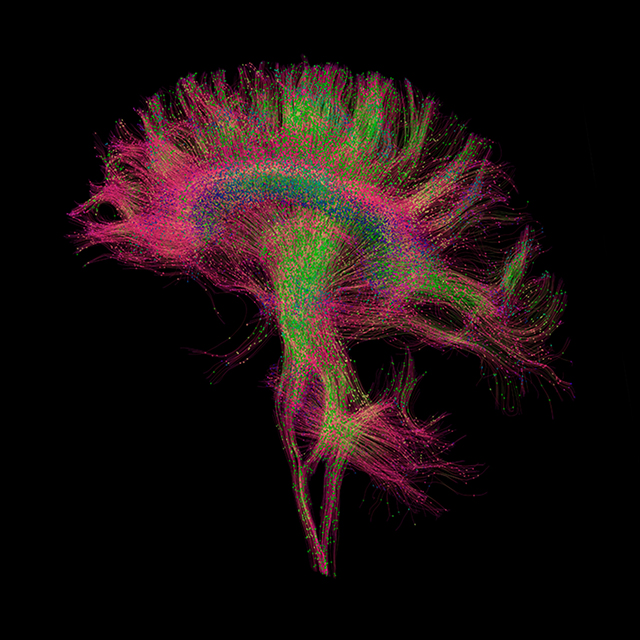 ucsf-department-of-radiology-research-2x