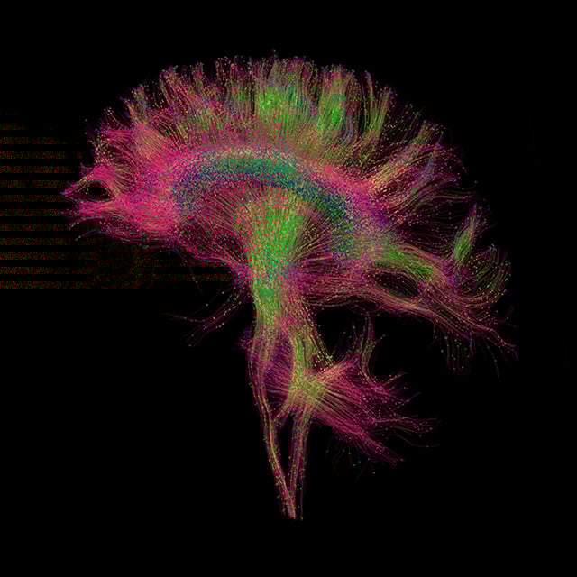 ucsf-department-of-radiology-research-2x