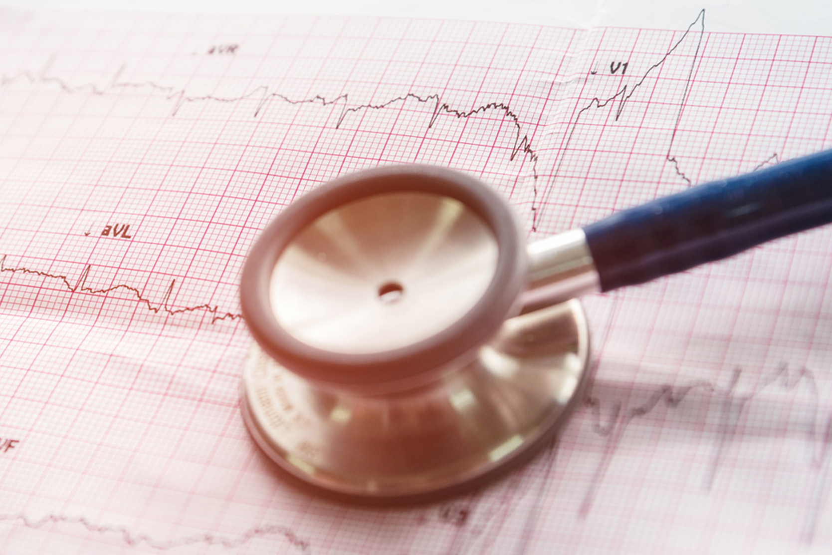 Electrophysiology Study and Catheter Ablation UCSF Benioff Children's