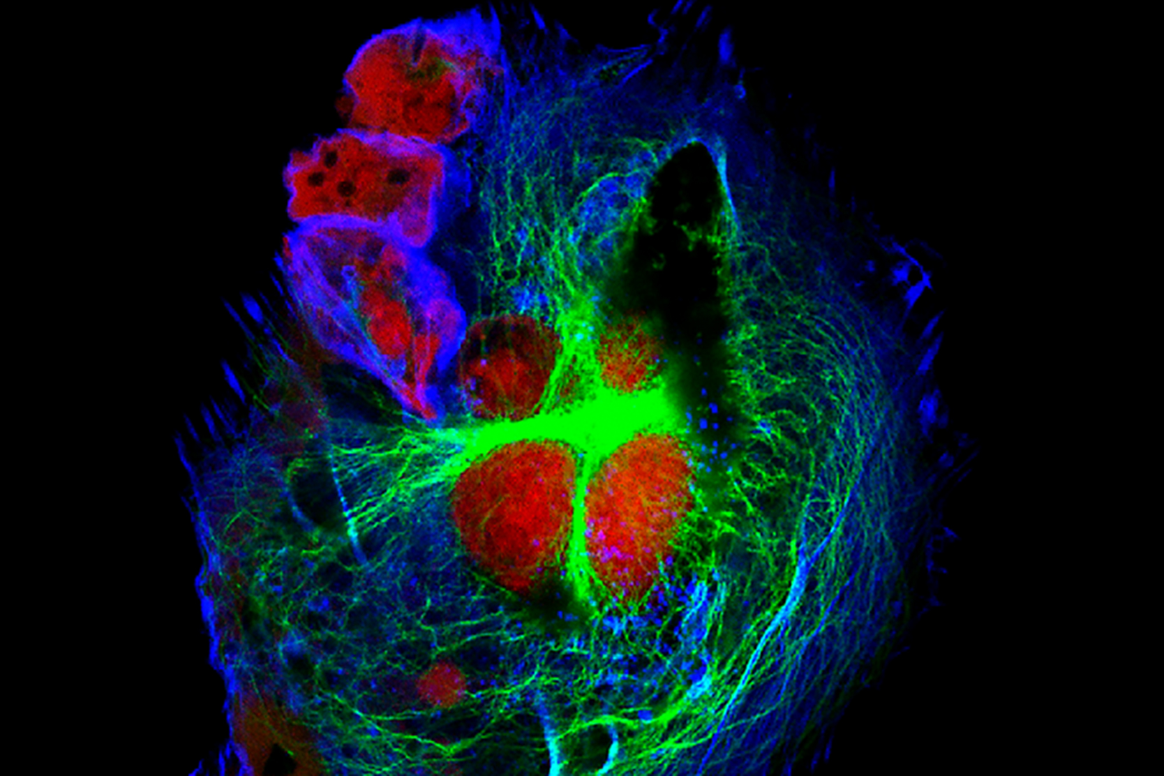 high-risk-neuroblastoma-treatment-options-2x