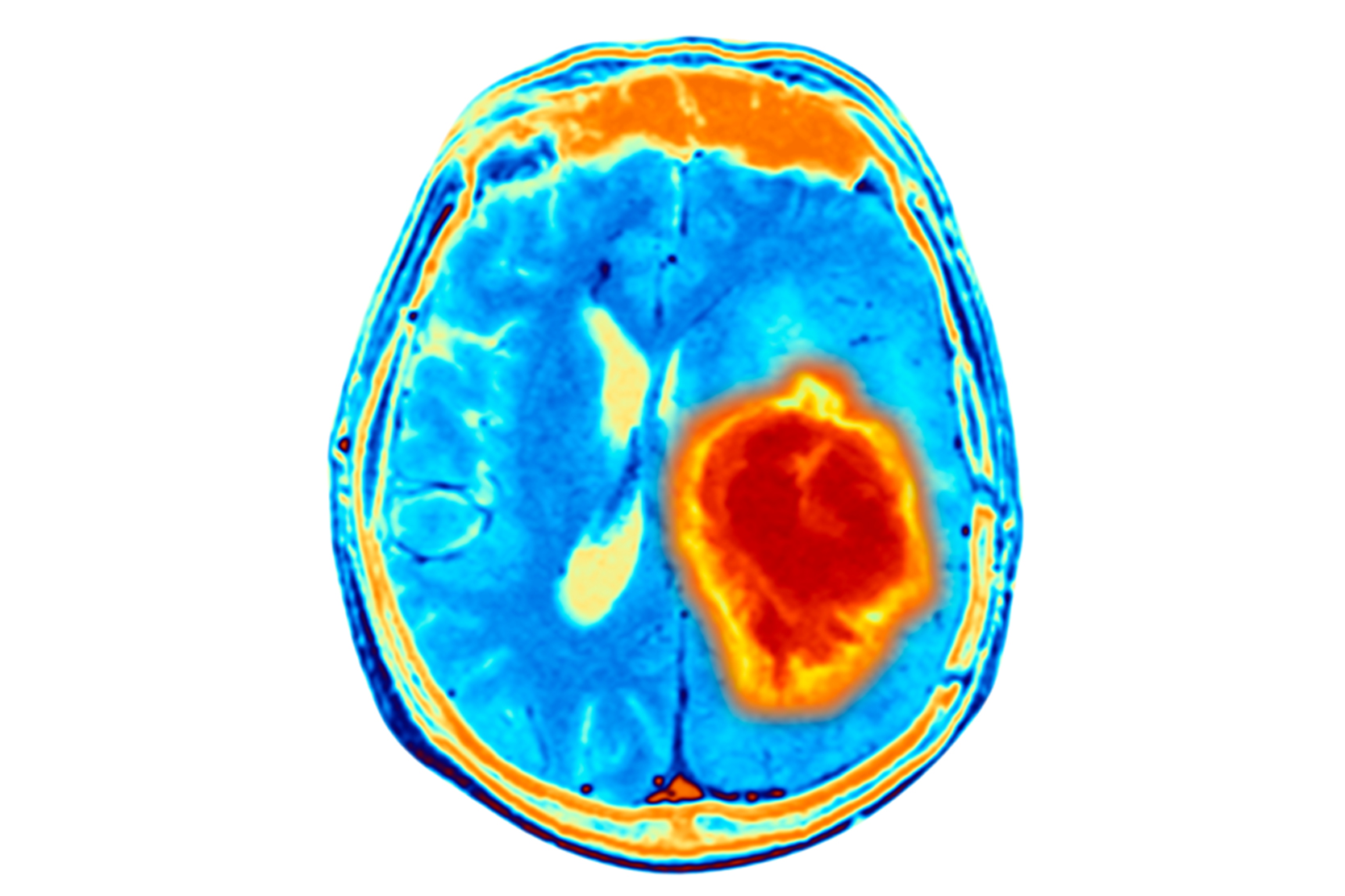 solid-tumor-and-brain-tumor-treatment-options-2x