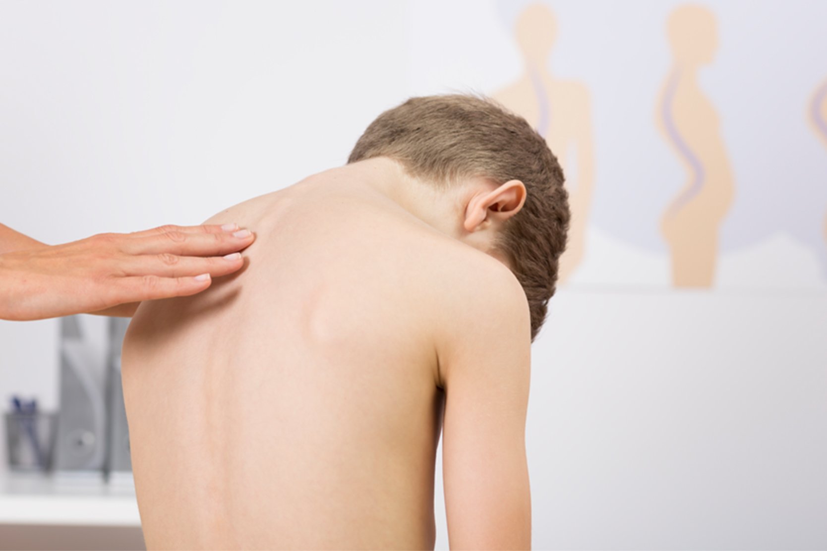 Spinal Fusion Surgery for Scoliosis | UCSF Benioff Children's Hospitals